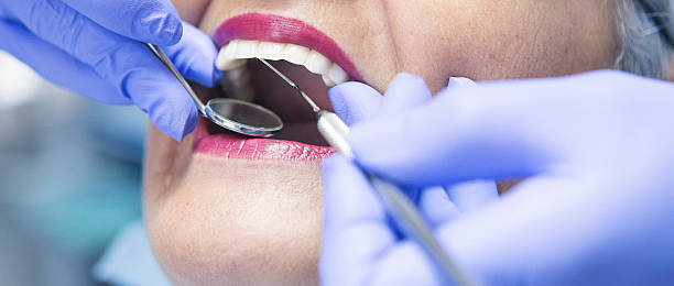 Best Emergency Dentist for Lost Fillings or Crowns in Iselin, NJ