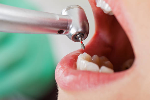 Best Weekend Emergency Dentist in Iselin, NJ